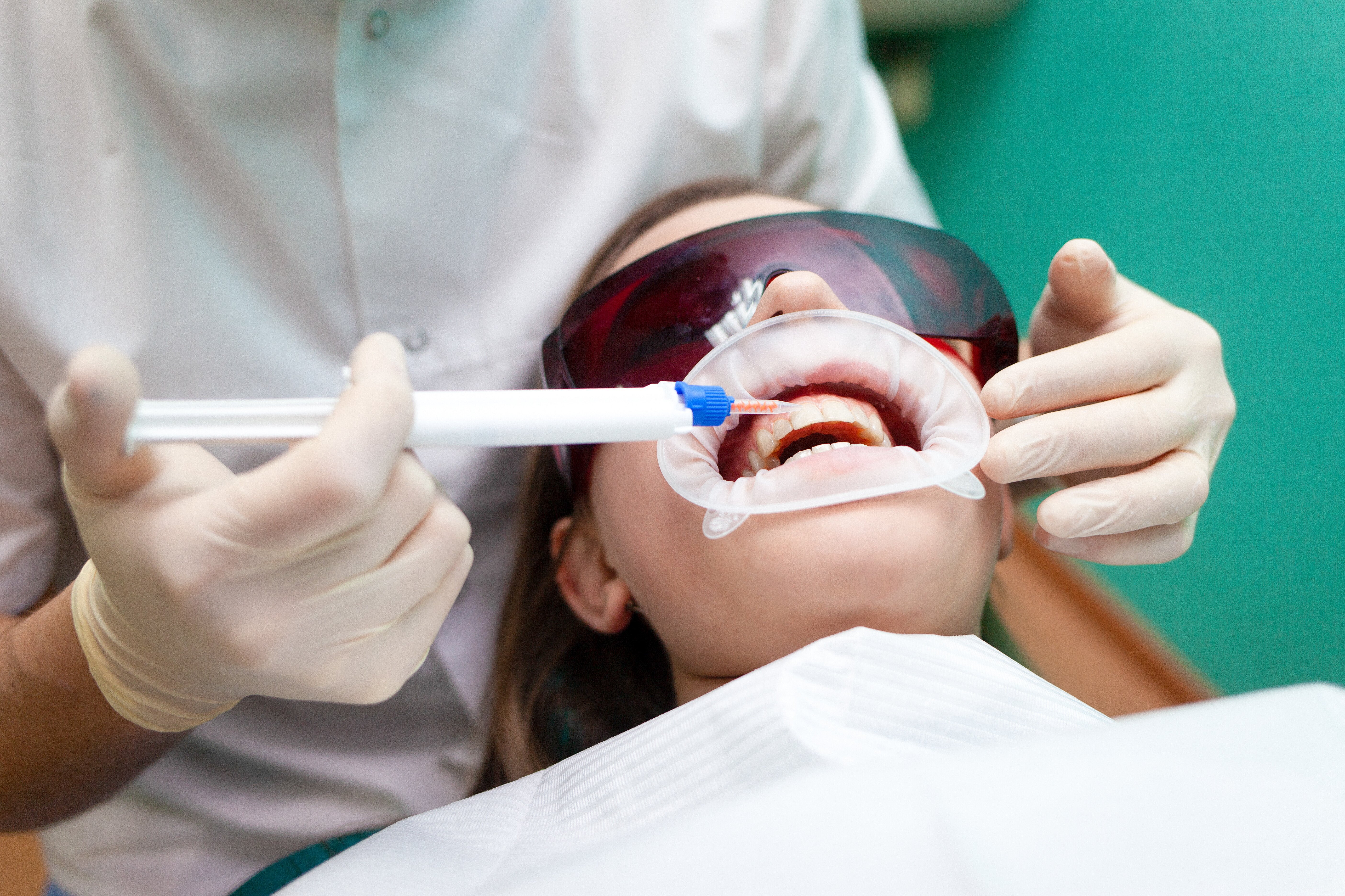 Dentist applies a tooth whitening gel with a syringe. Girl undergoes a teeth whitening procedure in a dental clinic.jpeg