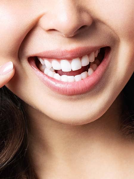 reasons-for-doing-gum-contouring-dental-care-oral-health-girl-teeth-smile(1).jpg