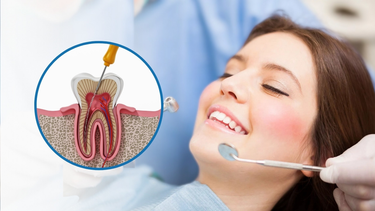 root-canal-cost-houston.jpg